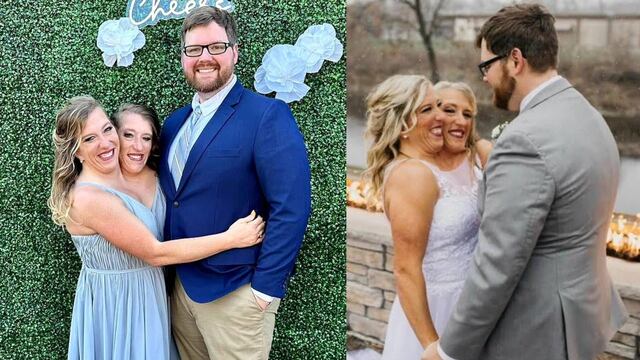 Confirman que una de las siamesas unidas por el cuello se casa